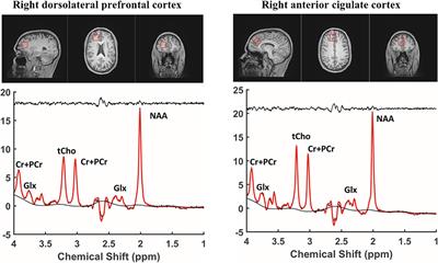 Proton magnetic resonance spectroscopy (MRS) in individuals with internet gaming